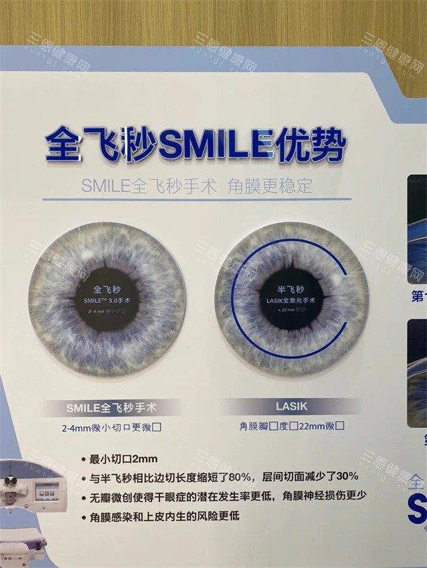 全飞秒SMILE优势