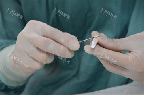 隆鼻手术膨体材料定性演示图
