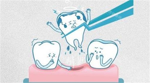 牙齿拔除卡通示意图