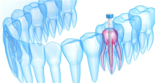 牙齿内部根管透视图