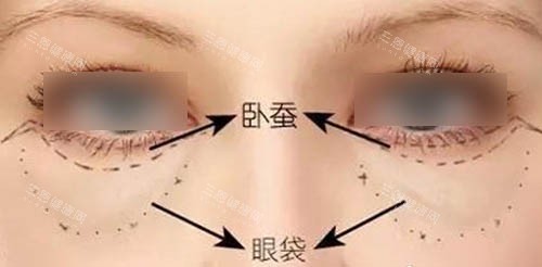眼周组织图