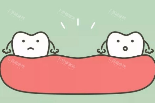 牙齿缺失卡通图片展示