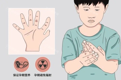 手指畸形漫画示意图