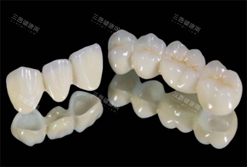 连冠的烤瓷牙 连冠的烤瓷牙