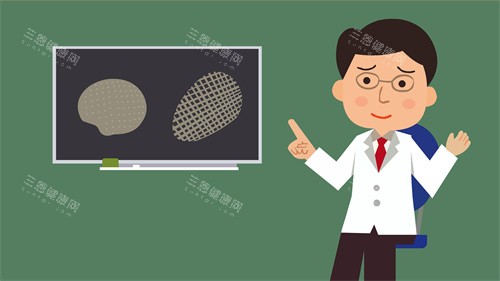 颅骨修复材料的对比动画图