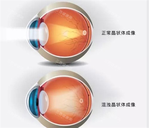 晶体表现图 晶体表现图