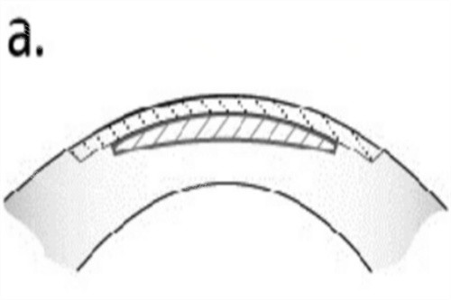 全飞秒透镜示意图 全飞秒透镜示意图