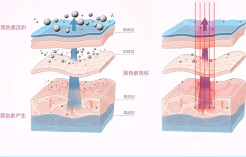 贵阳惺悦皮肤美白内部作用层次示意图
