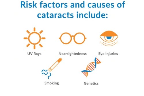 白内障病因 白内障病因