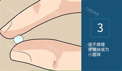 正畸保护蜡使用步骤
