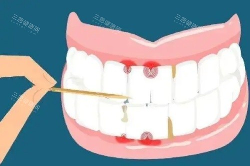 牙签剔牙卡通图