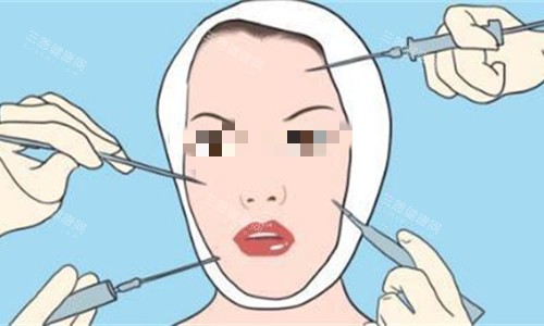 面部整形漫画示意图