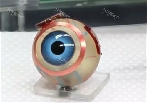 仿生眼球的样子
