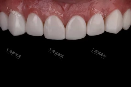 牙齿护理宣传图