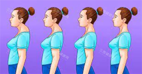 不同程度的富贵包 不同程度的富贵包