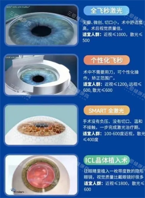 不同近视手术类型适宜人群图解