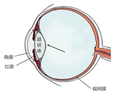 眼球结构示意图