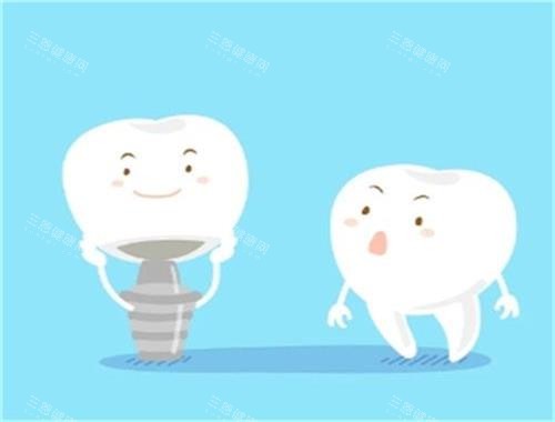 种植牙和健康牙对比图
