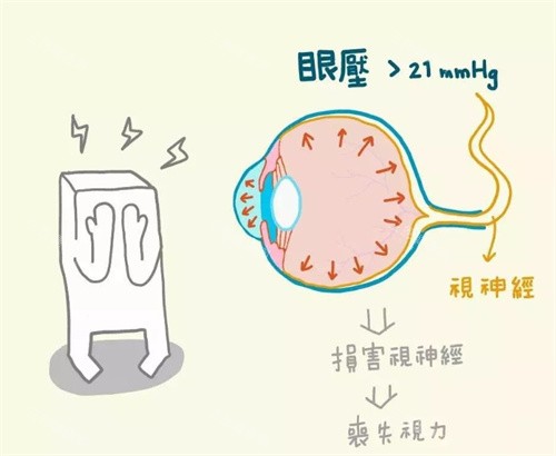 青光眼图片