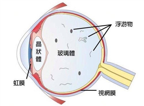 玻璃体图示