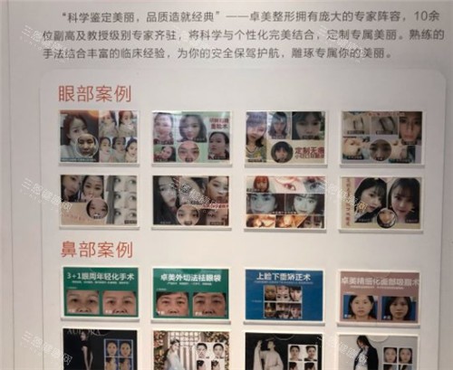 武汉硚口卓美整形展示墙