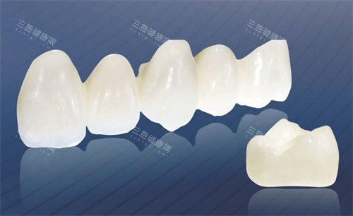 浏阳牙科泽康全瓷牙