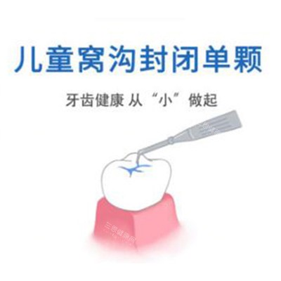 儿童口腔窝沟封闭