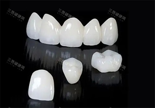 不同位置的全瓷牙 不同位置的全瓷牙