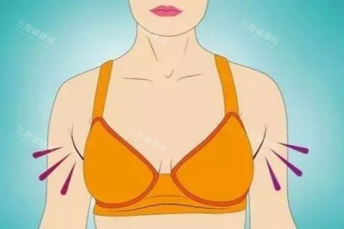 副乳图片展示