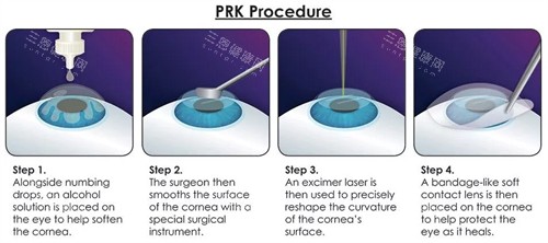 表层手术过程 表层手术过程