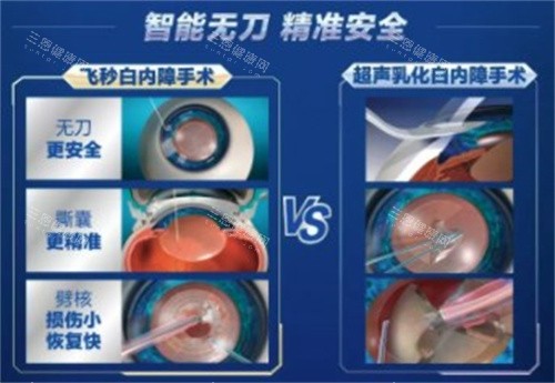 爱尔眼科白内障手术
