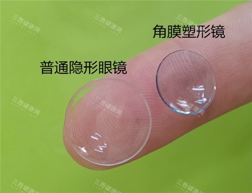 普通眼镜和角膜塑形镜对比照片