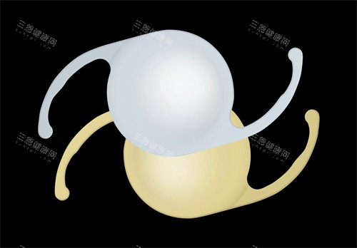 爱尔康人工晶体图片展示