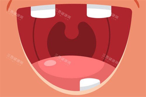 缺牙动画