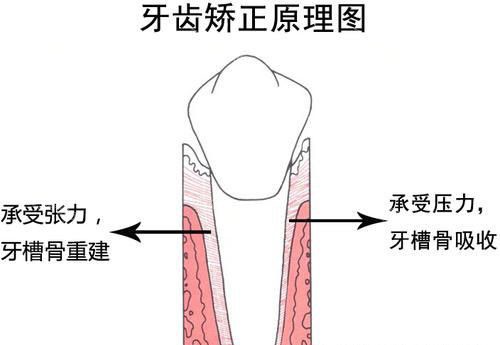嘉兴海盐县益品口腔牙齿矫正正畸原理