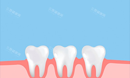 嘉兴海盐县益品口腔牙齿动画展示图
