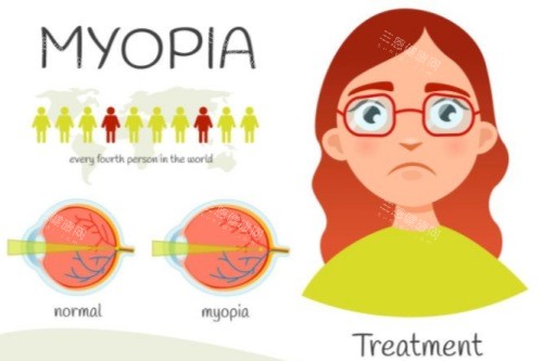 青少年近视 青少年近视