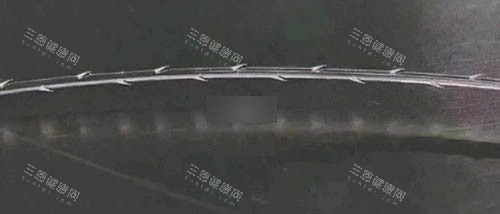 面部埋线耗材