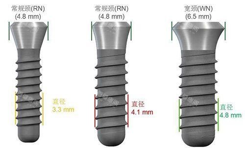 种植牙尺寸规格种类图