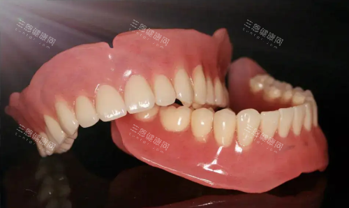 吸附性义齿图片