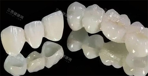 二氧化锆全瓷牙
