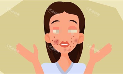 面部伤疤密布卡通图