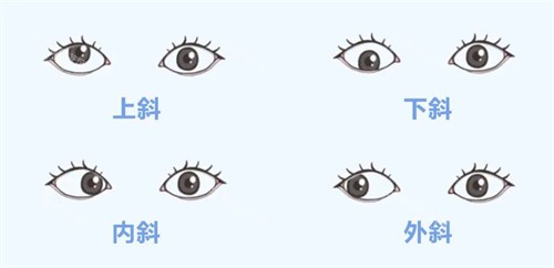 上斜下斜内斜外斜的区别