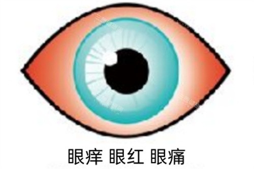 眼红