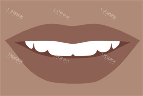 牙齿洁白图