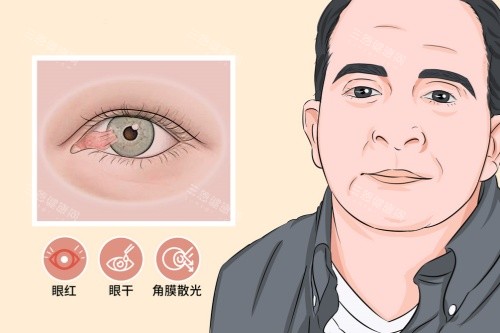 吉大二院眼科翼状胬肉症状