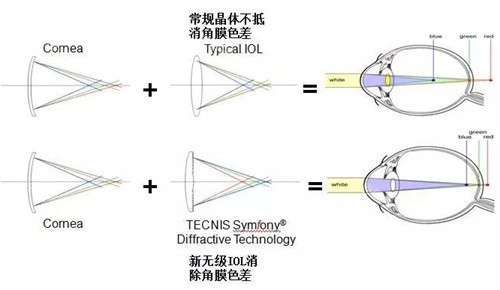 新无极人工晶体的优点