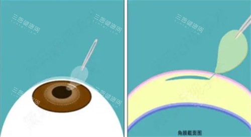 北京协和医院眼科在哪个院区？据了解，医院在东院和西院都有开诊眼科，东院看疑难西院做激光！