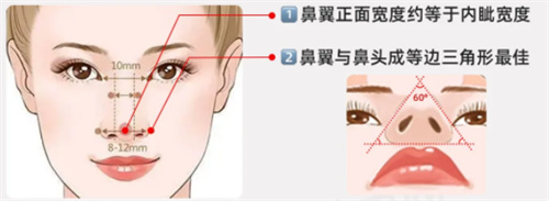 鼻翼缩小鼻翼图