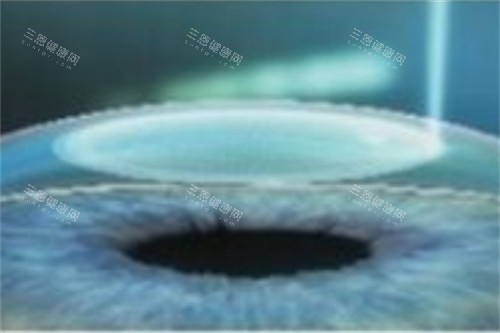 遵义医科大学附属医院眼科地址：大连路149号！预约打2860/营业至16:30/口碑好！